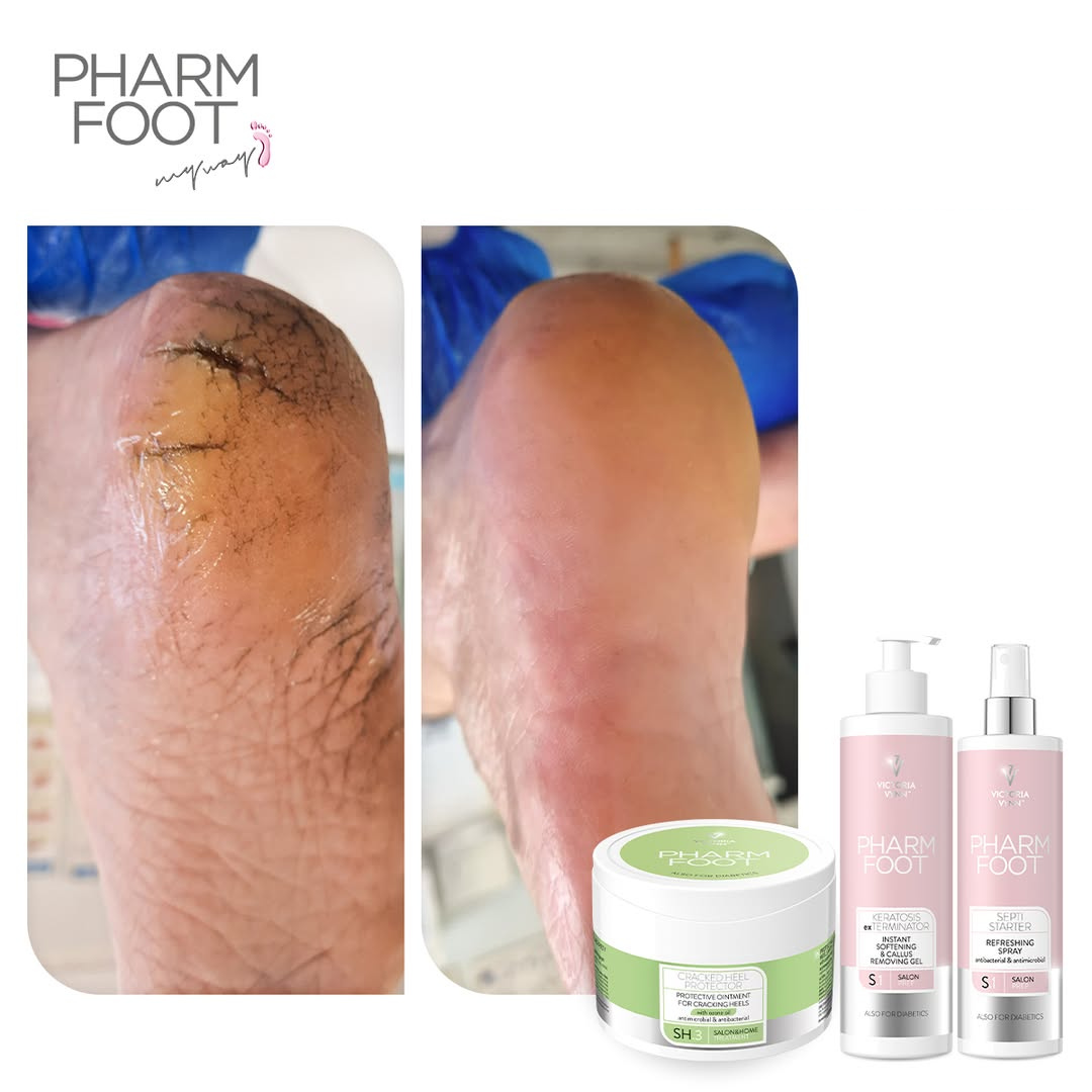 PHARM FOOT Набор для ухода за потрескавшимися пятками и кожей стоп