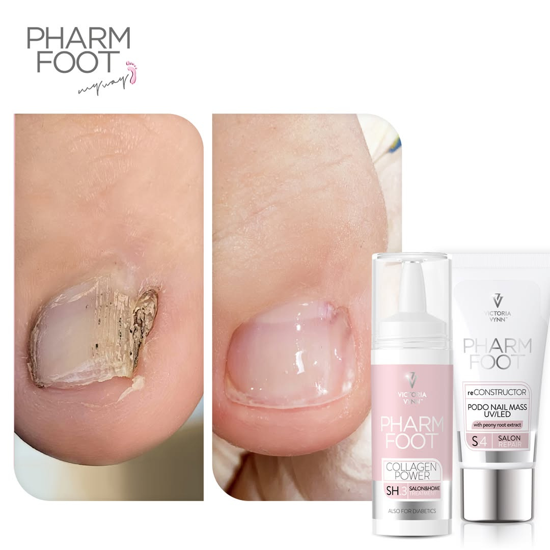 PHARM FOOT Nail reconstructor, reConstructor Podo Nail Set UV/LED