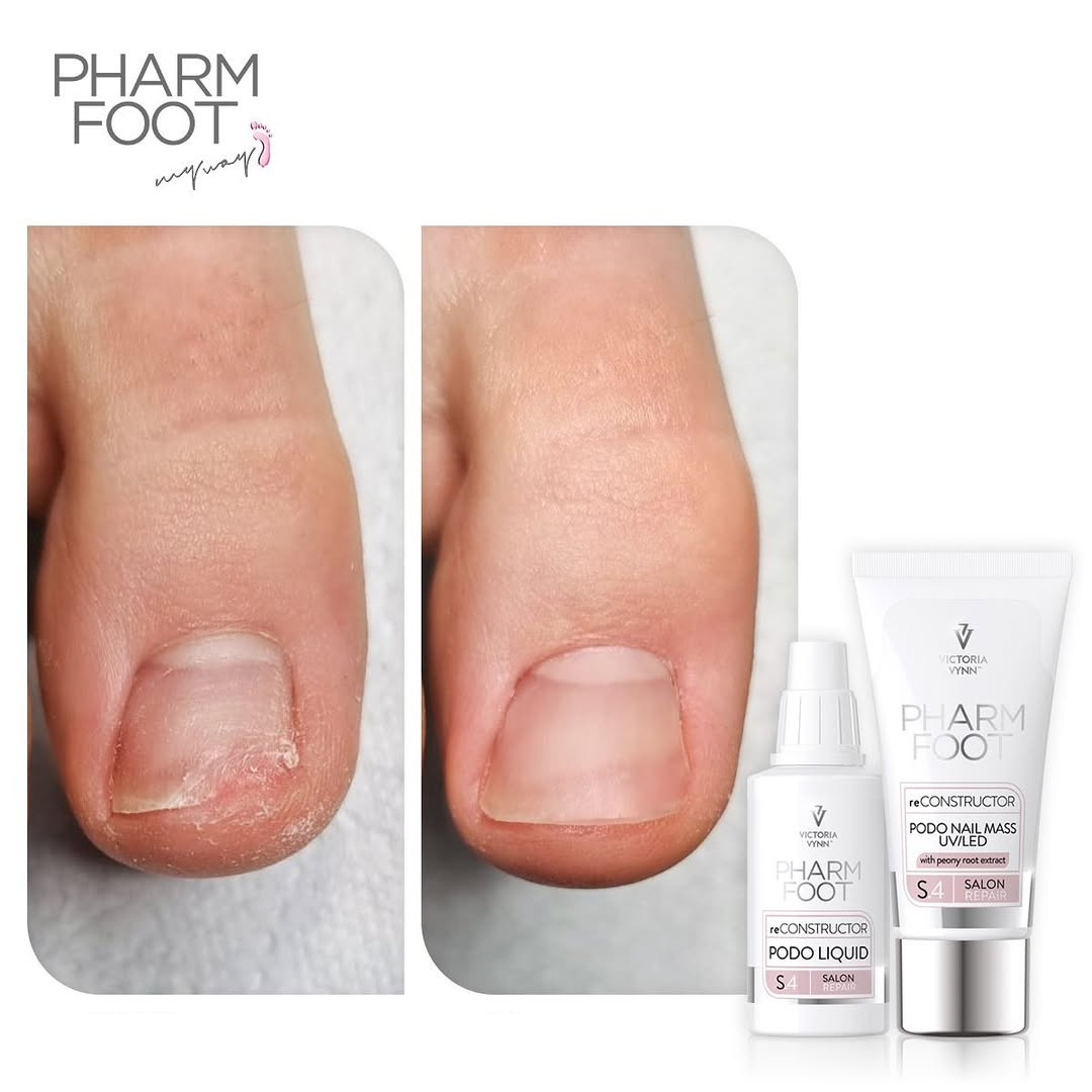 PHARM FOOT Nail reconstructor, reConstructor Podo Nail Set UV/LED
