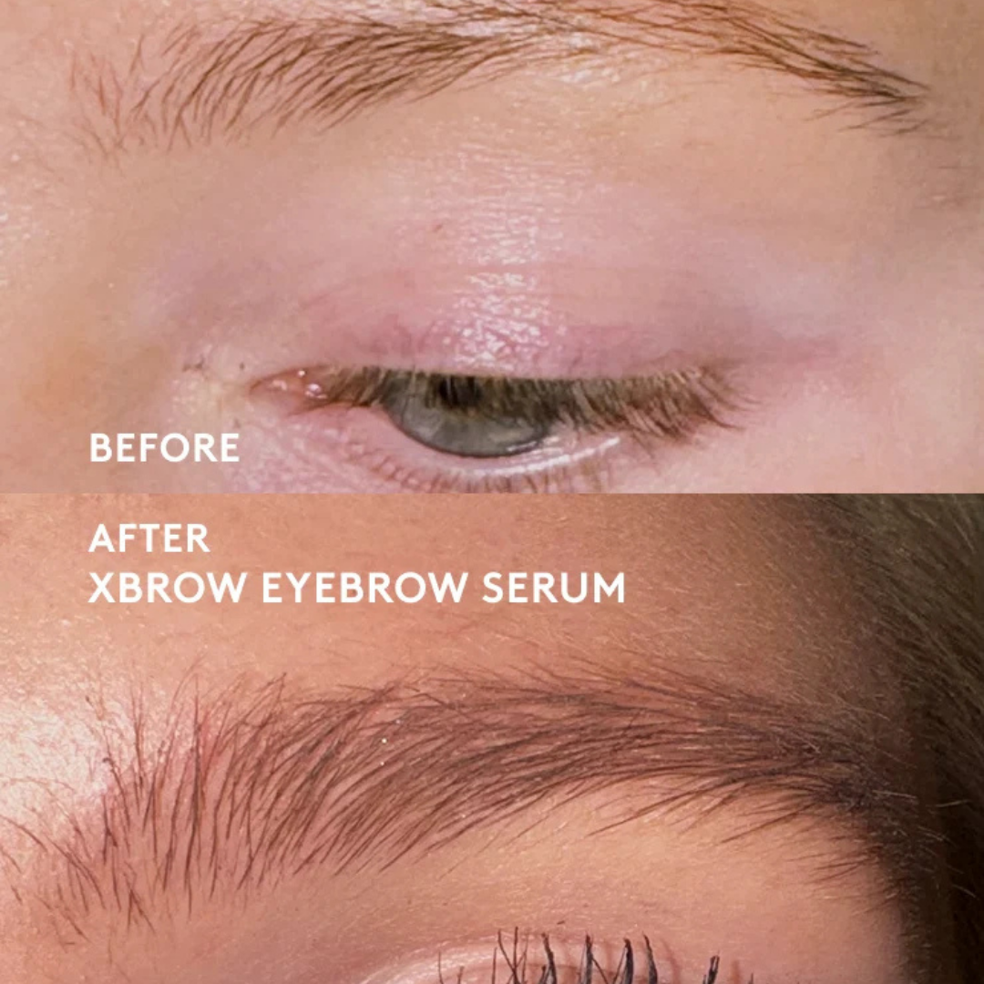 XLASH Xbrow antakių serumas – antakių serumas, 3 ml