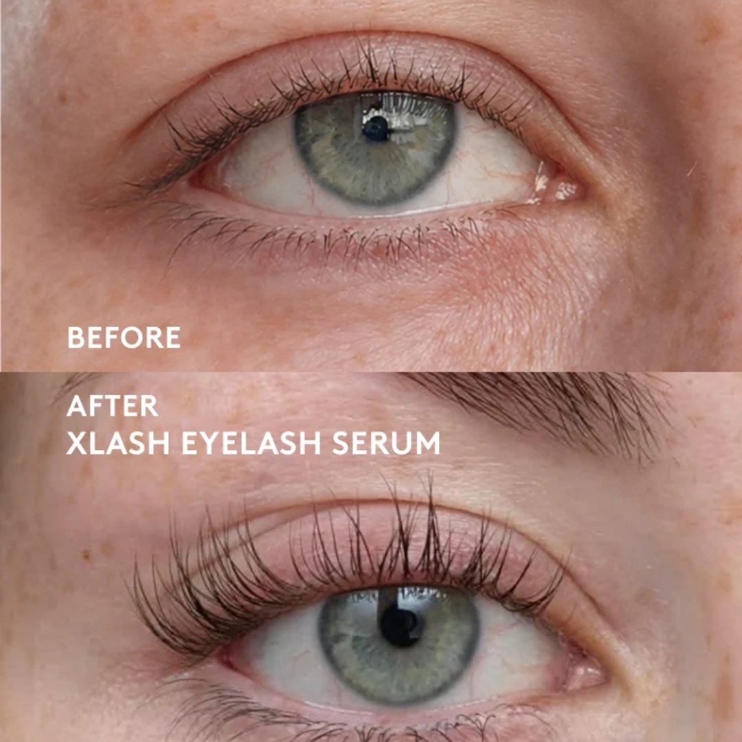 XLASH Eyelash Serum – blakstienų serumas, 3 ml