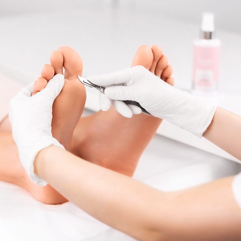 PHARM FOOT Спрей для смягчения кожи и мозолей, OSMO TONIC 150ml