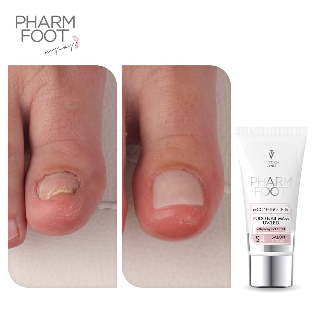 PHARM FOOT Nail reconstructor, reConstructor Podo Nail Set UV/LED