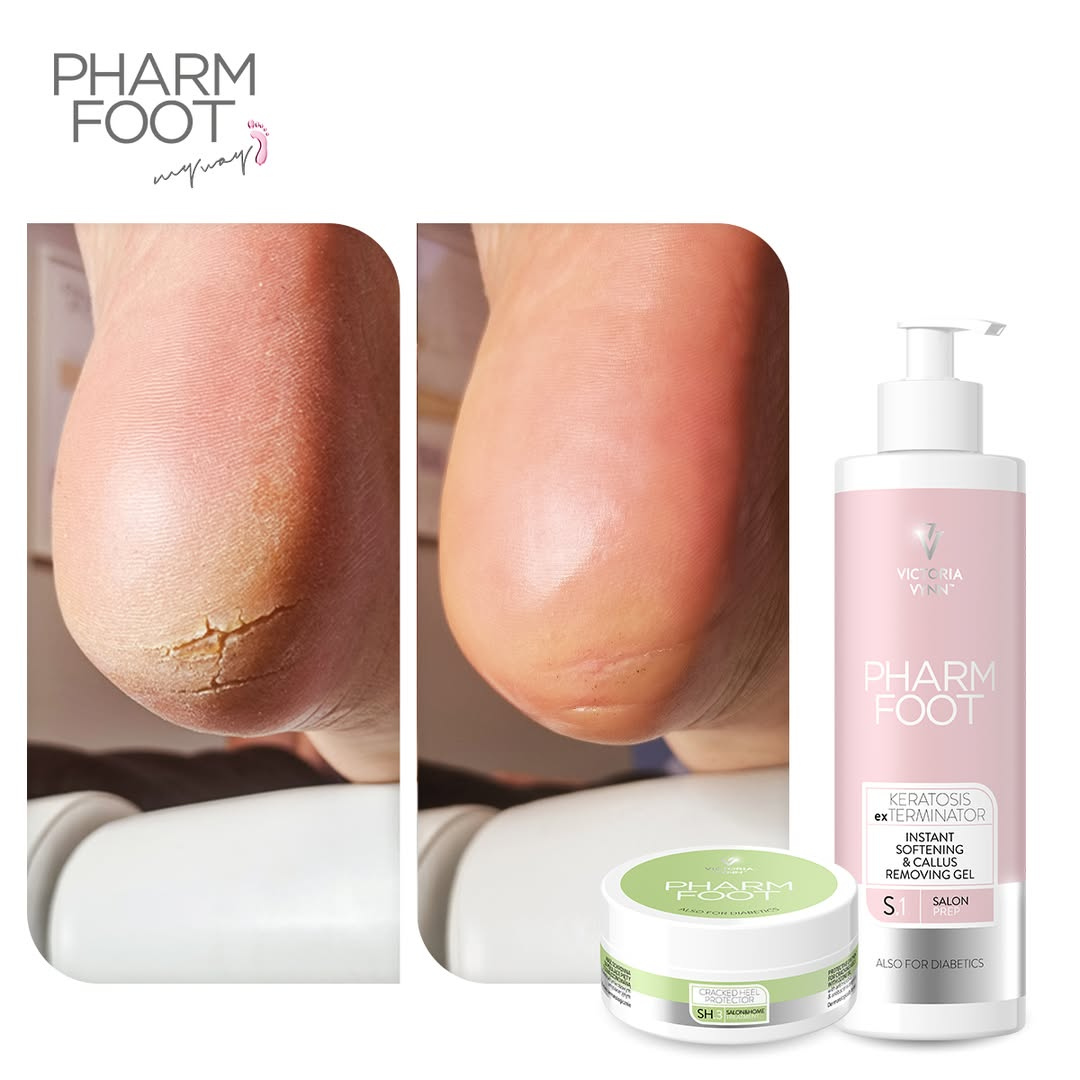 PHARM FOOT Rinkinys suskilusių kulnų ir pėdų odos priežiūrai