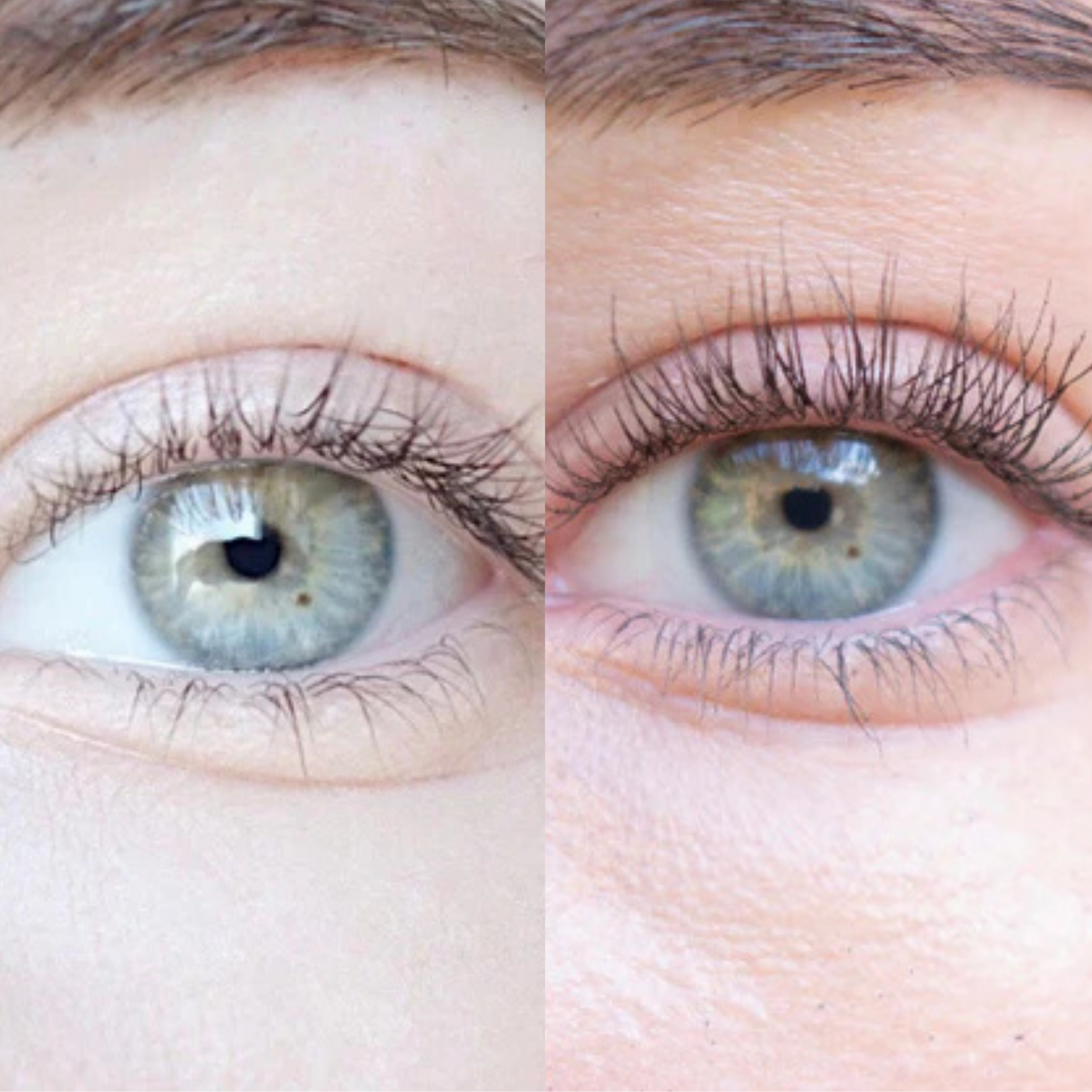 XLASH Skropstų Serumas - skropstų serumas, 5 ml