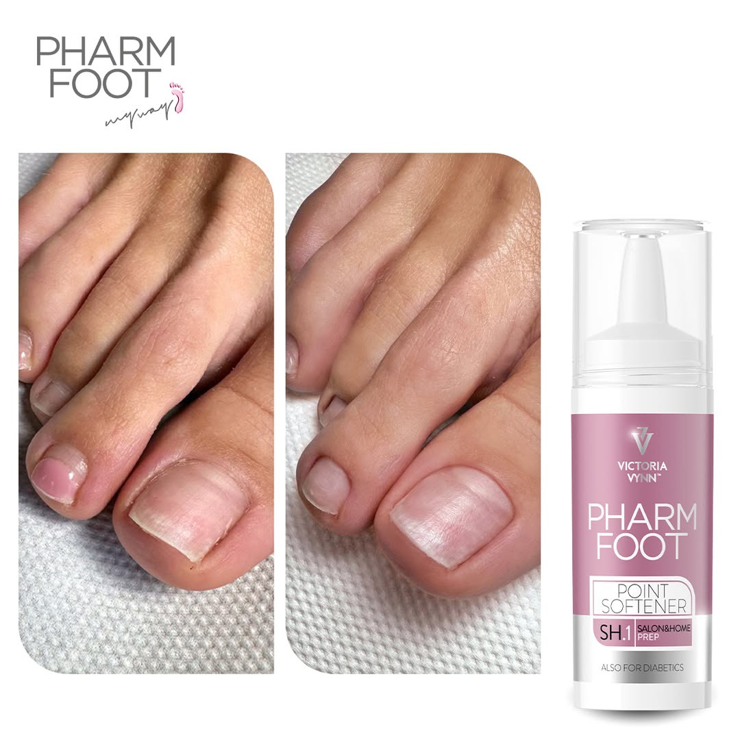 PHARM FOOT Liquid for ingrown nails, POINT SOFTENER 15ml