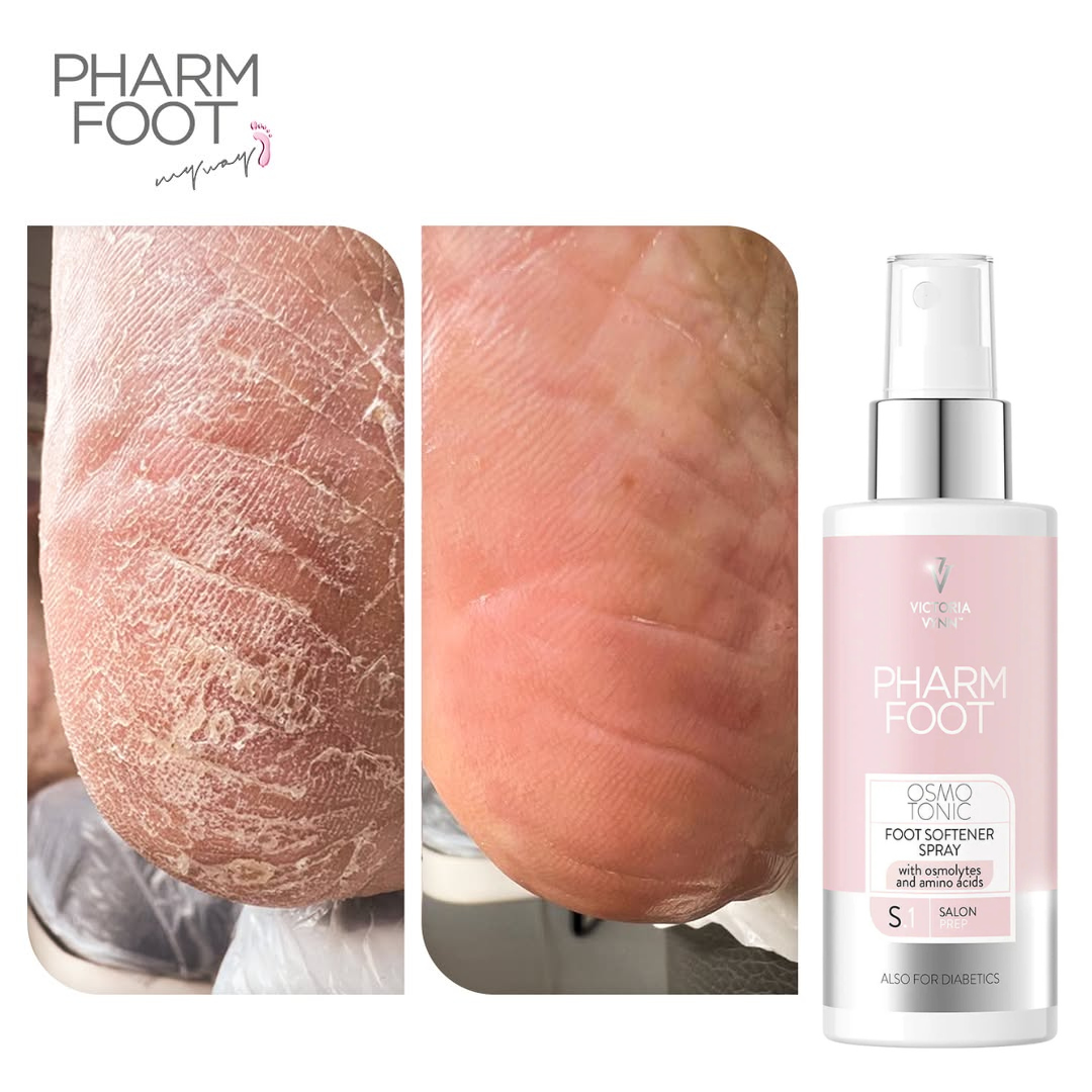 PHARM FOOT Odos ir nuospaudų minkštiklis, OSMO TONIC (papildymas), 400ml